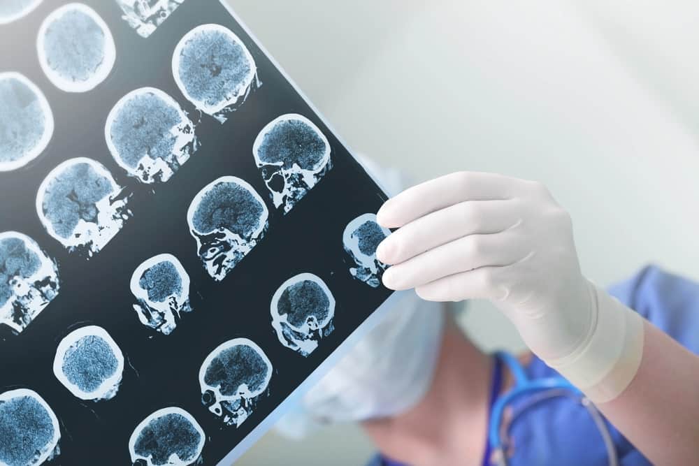 medical malpractice