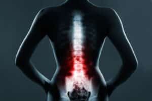 Spinal Cord Injuries Alabama